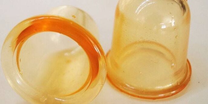 բաժակներ պրոստատիտի բուժման համար